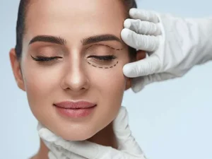 انواع جراحی زیبایی پلک