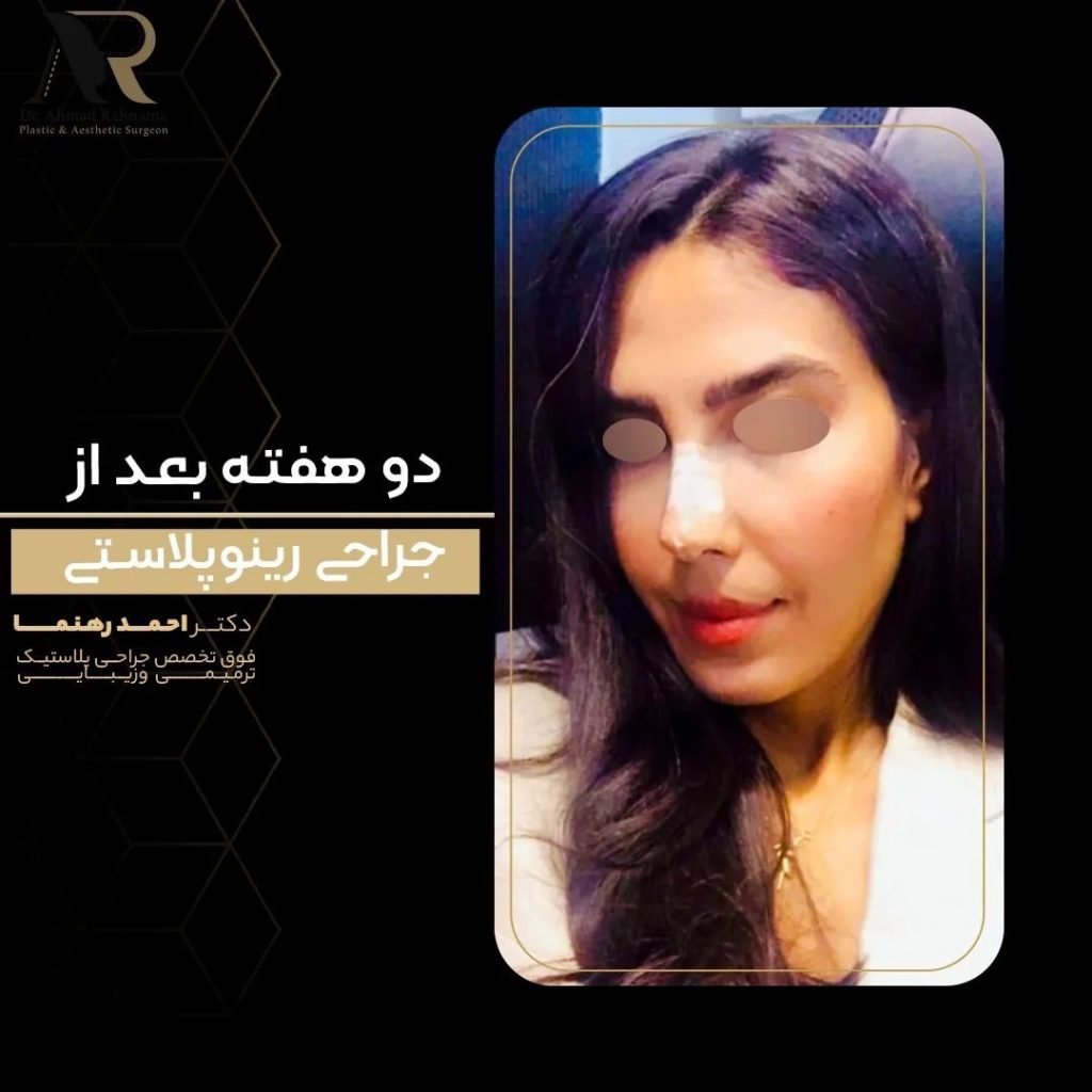 قیمت جراحی رینوپلاستی