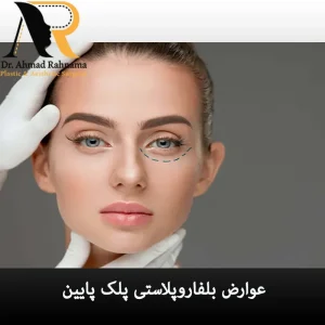 عوارض جراحی بلفاروپلاستی