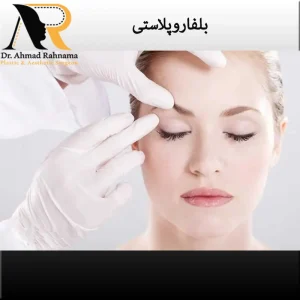 هزینه عمل بلفاروپلاستی