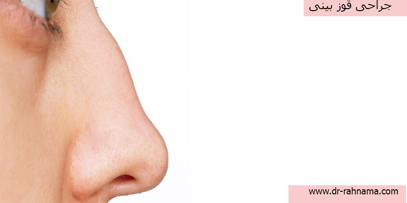 جراحی-قوز-بینی-چیست؟