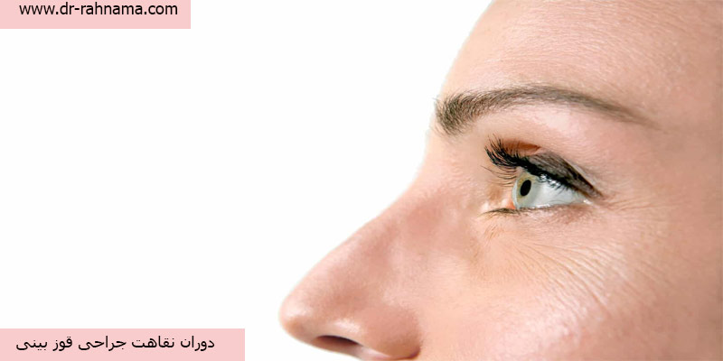 دوران نقاهت جراحی قوز بینی