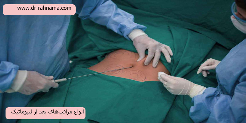 انواع-مراقبت-های-بعد-از-لیپوماتیک