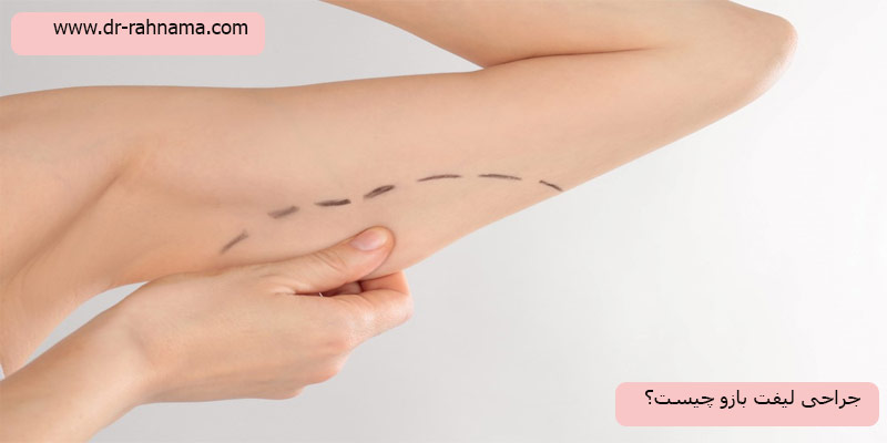 جراحی-لیفت-بازو-چیست؟