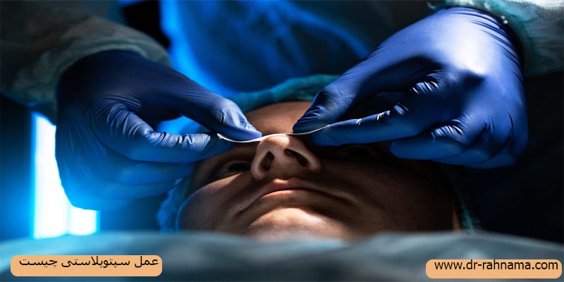عمل-سپتوپلاستی-چیست؟