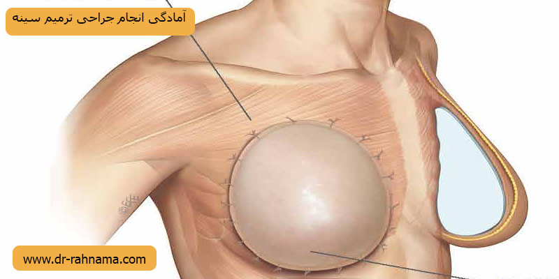 آمادگی-جراحی-ترمیم-سینه