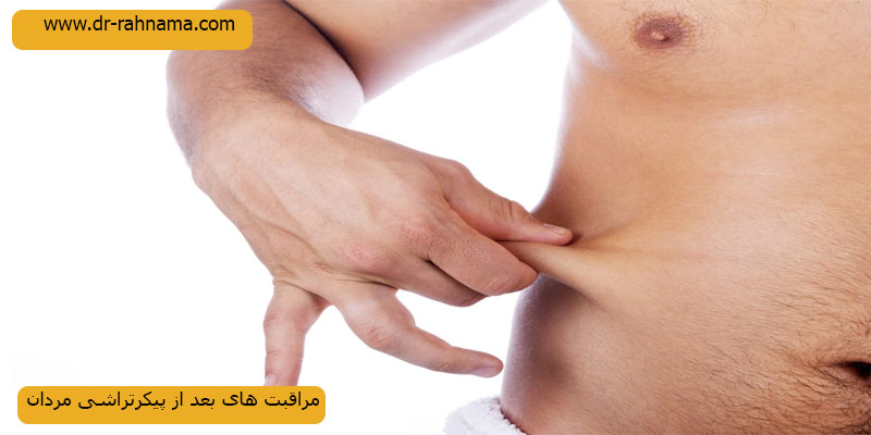 مراقبت-های-بعد-از-جراحی-پیکرتراشی-مردان
