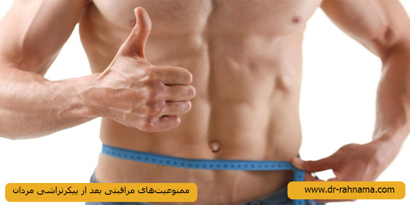 ممنوعیت-های-مراقبتی