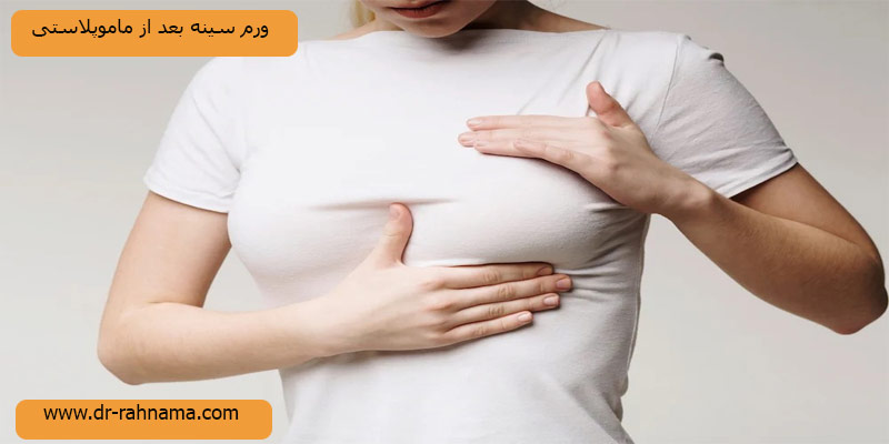 ورم-سینه-بعد-از-ماموپلاستی