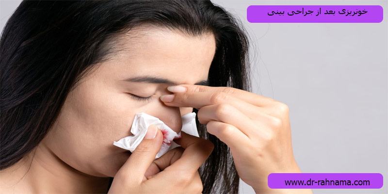 جراحی-بینی