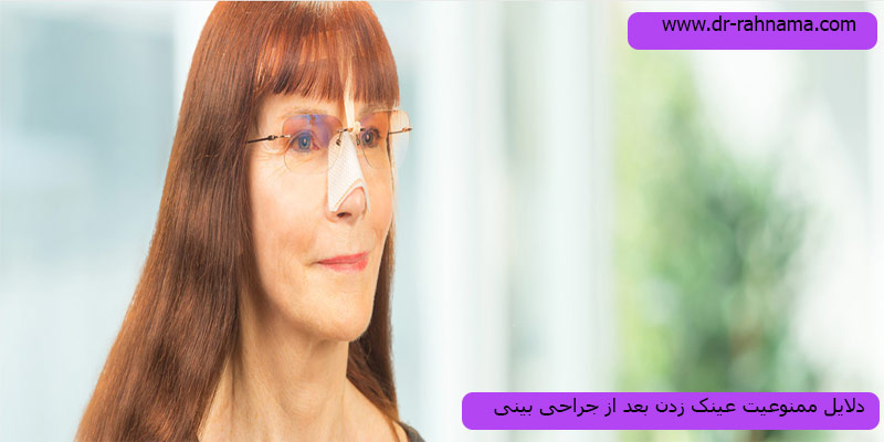 عینک-زدن