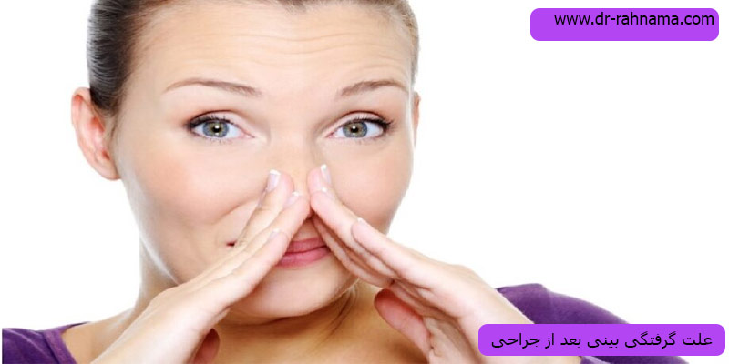 گرفتگی-بینی-بعد-از-جراحی