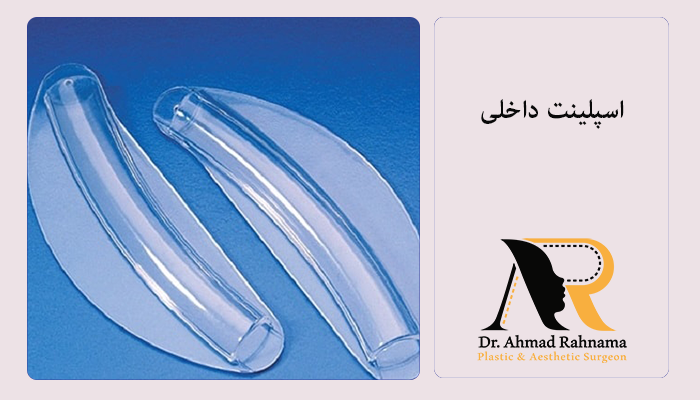 اسپلینت بینی