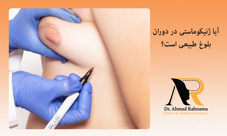 آیا-ژنیکوماستی-در-دوران-بلوغ-طبیعی-است؟