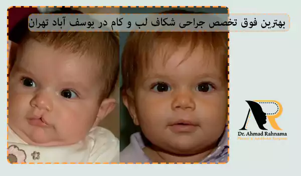 بهترین فوق تخصص جراحی شکاف لب و کام در یوسف آباد تهران