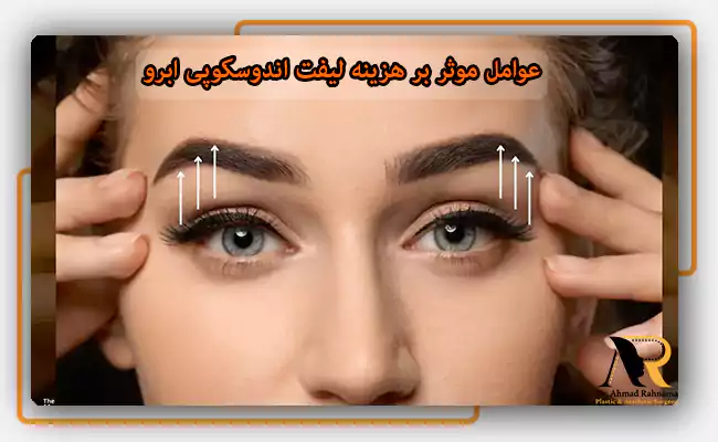 عوامل موثر بر هزینه لیفت اندوسکوپی ابرو