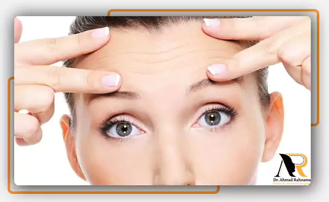 نکات مراقبت های بعد از لیفت اندوسکوپی ابرو